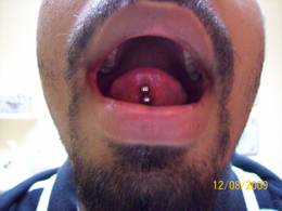 tongue piercing san diego